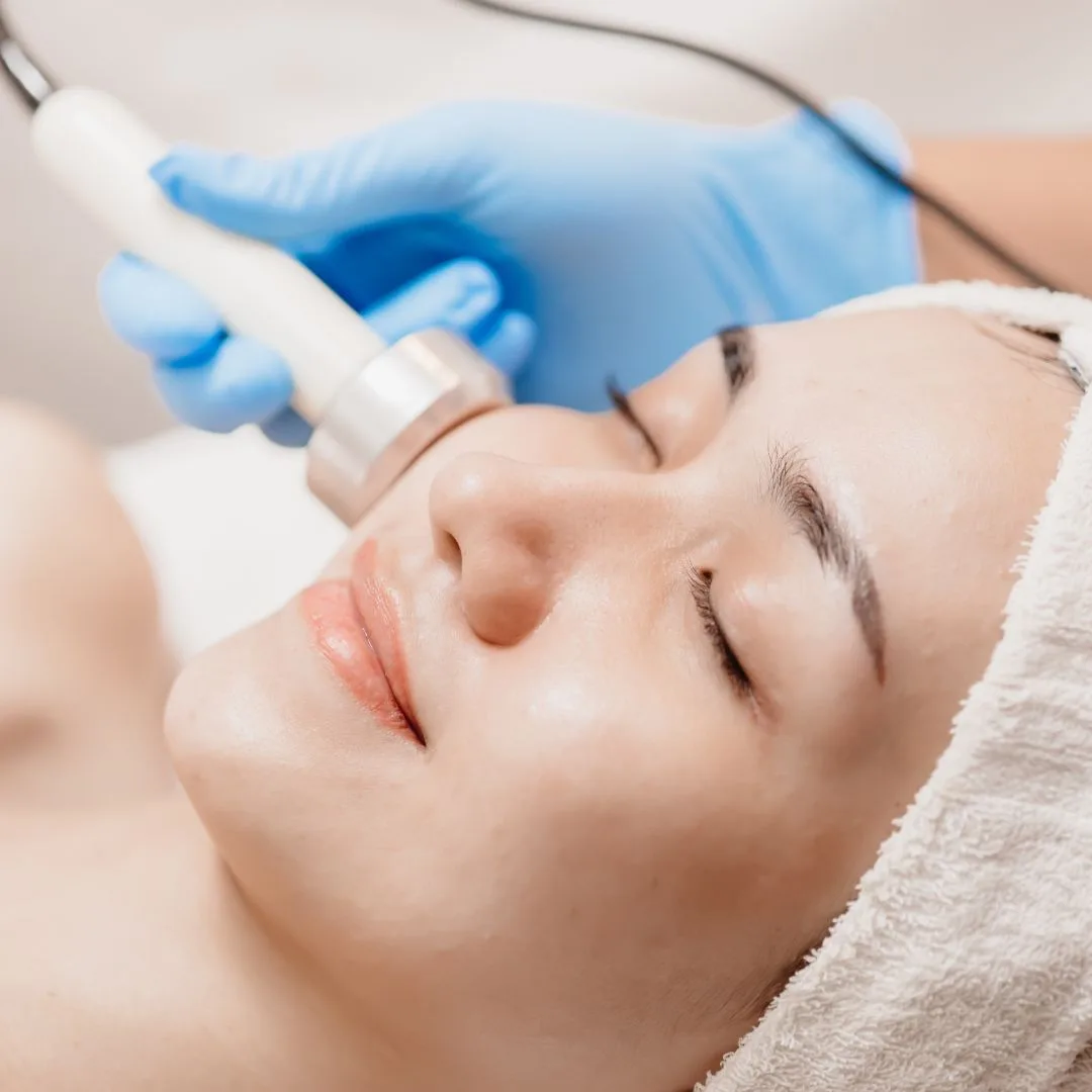 RF Facial Contouring