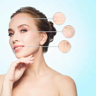 Microneedling