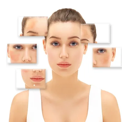 Hyperpigmentation